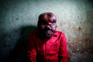 Godfrey Baguma: The ugliest man in the world | My Uganda